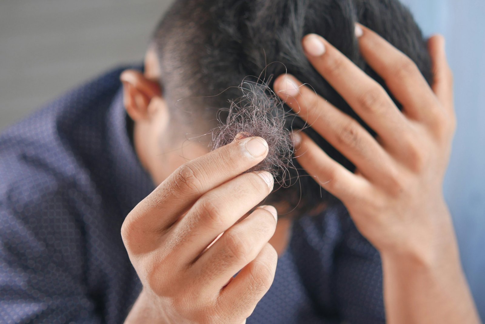 The Best Hair Loss Treatments for Men in 2025: From Minoxidil to Natural Oils